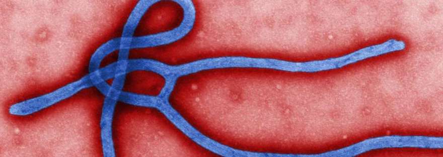 9 Virus Paling Mematikan di Dunia